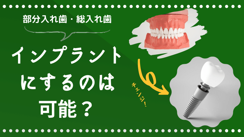 入れ歯からインプラント