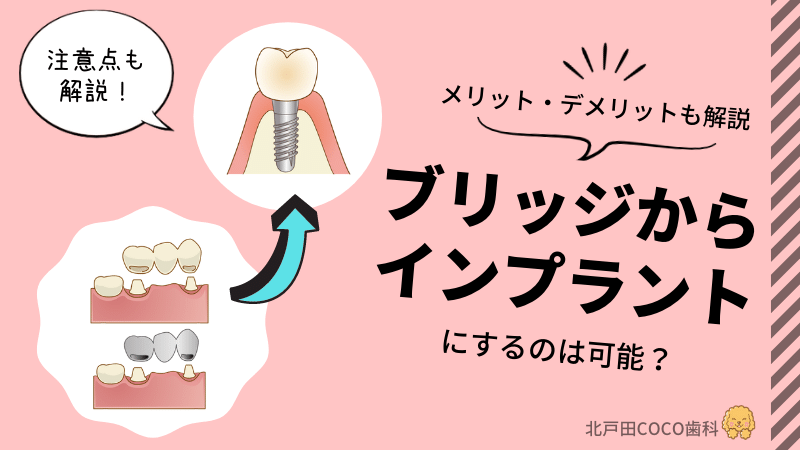 ブリッジからインプラントにするのは可能？メリット・デメリットを解説