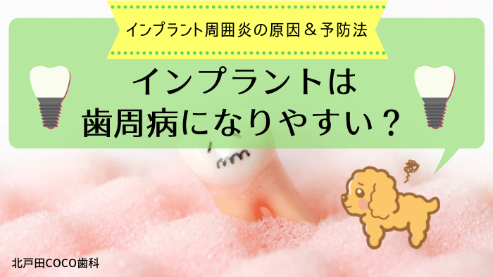 インプラントは歯周病になりやすい？インプラント周囲炎の原因と予防法