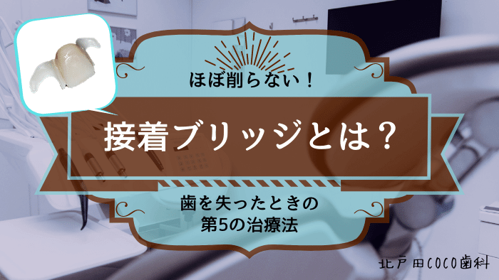 接着ブリッジとは？歯を失ったときの第5の治療法を徹底解説