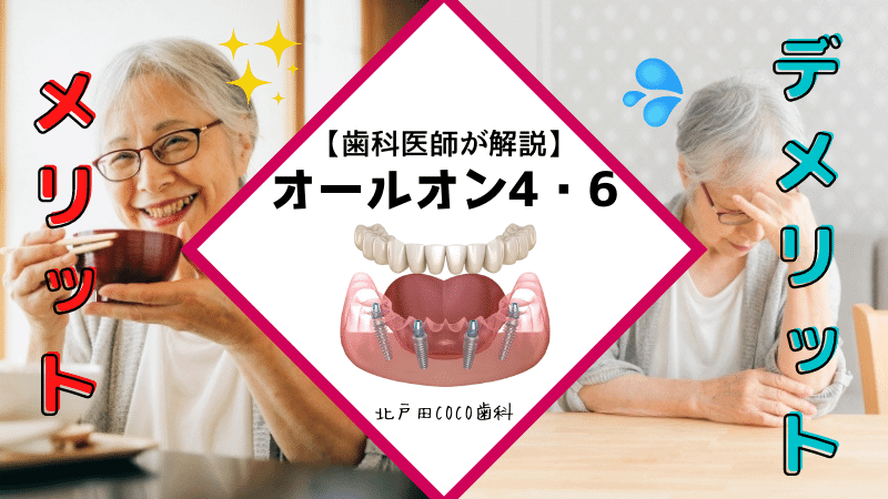 オールオン4・6のメリット・デメリット！よくある質問に歯科医師が回答