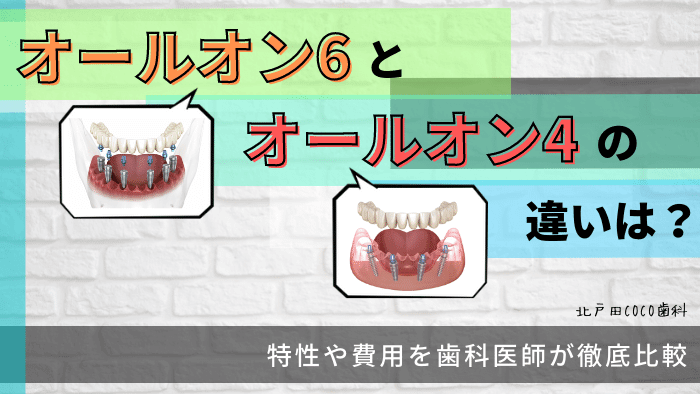 オールオン6とは？オールオン4との違いや費用を徹底解説