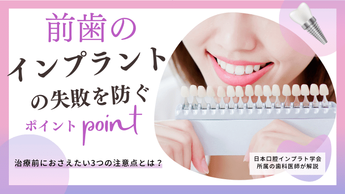 前歯のインプラントの注意点3選＆対処法！失敗を防ぐポイントとは？