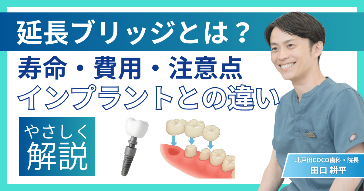 延長ブリッジとは何かを解説したアイキャッチ画像。費用・寿命・注意点・インプラントとの違いを歯科医がやさしく紹介