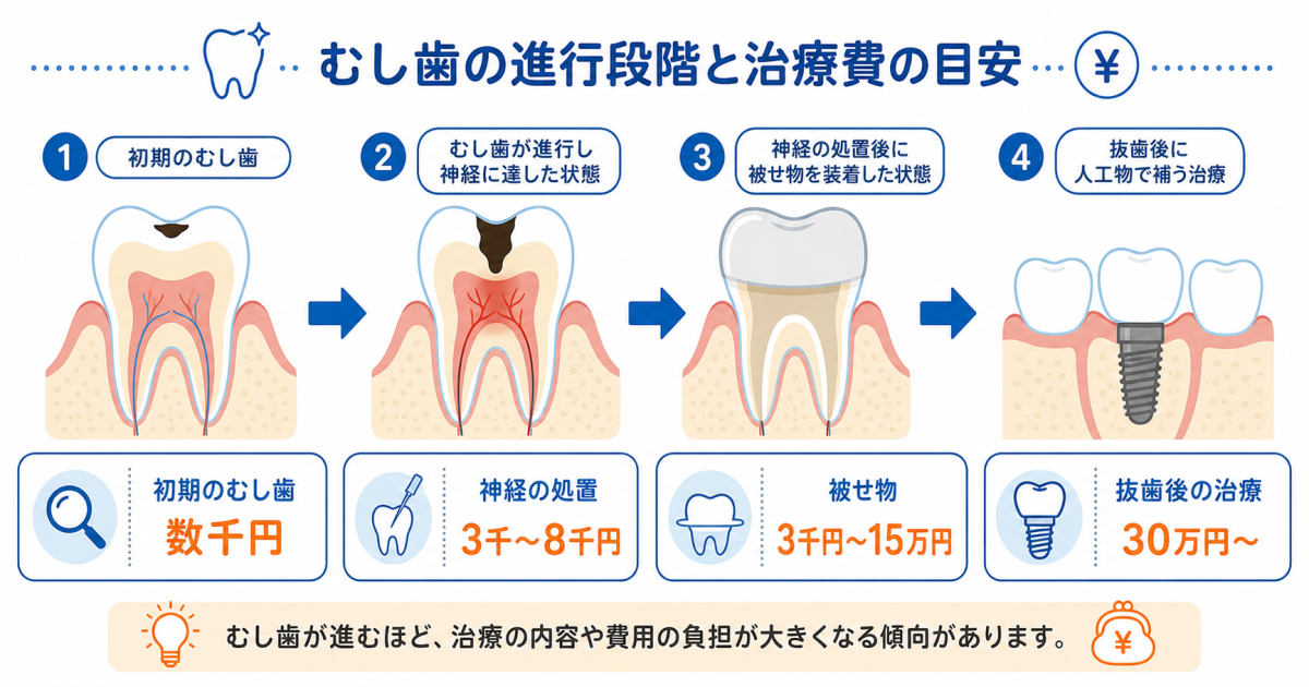 痛くなってから歯医者に通うリスクと受診費用の実態